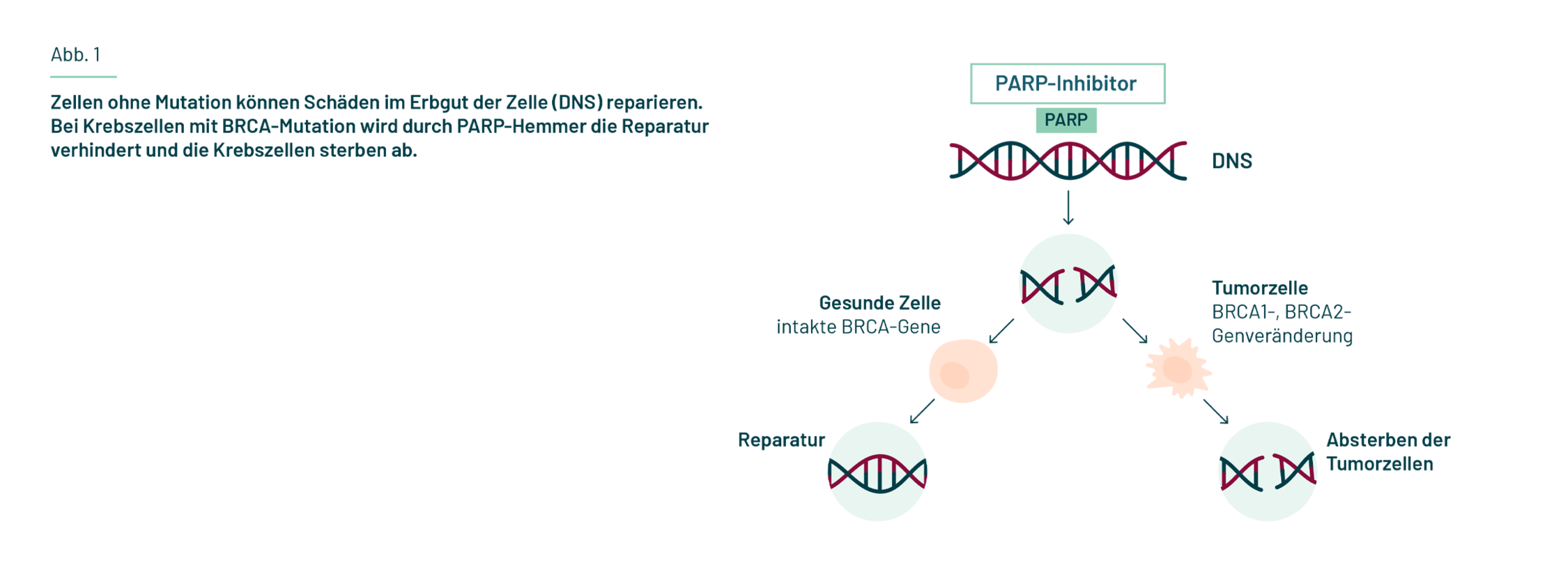 Es ist die DNS als Strang abgebildet, an die das Enzym PARP mit verbundenem PARP-Hemmer bindet. Ein Pfeil führt zu einem unterbrochenen DNS-Strang. Danach teilt sich die Abbildung in zwei Stränge. Im ersten Strang ist eine gesunde Zelle ohne BRCA-Mutation abgebildet, in der der unterbrochene DNS-Strang repariert wird. Im zweiten Strang ist eine Krebszelle mit BRCA-Mutation abgebildet, in der die Unterbrechung nicht repariert wird und zum Absterben der Krebszelle führt. 