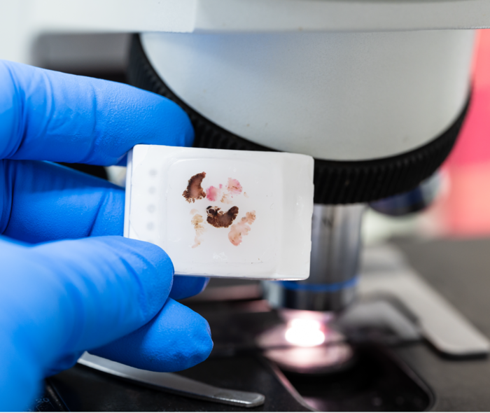 Abgebildet ist ein Paraffinblock, in dem Gewebe in der Pathologie für Feinschnitte aufbereitet wird.