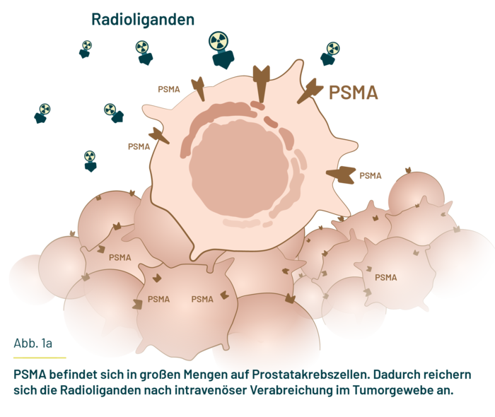 Auf der Zeichnung ist Gewebe mit einzelnen Zellen zu sehen, in denen sich Radioliganden befinden. Auf der Zeichnung ist Gewebe mit Krebszellen zu sehen, die das Eiweiß PSMA aufweisen. Radioliganden reichern sich an.
