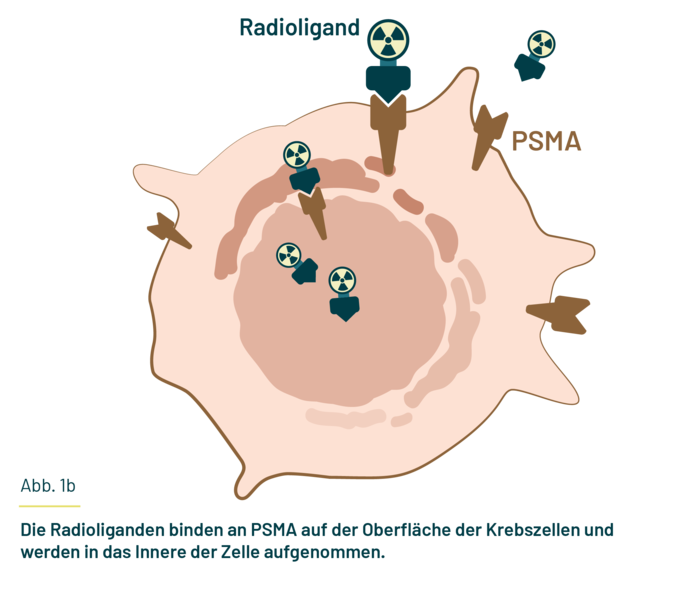 Es ist eine Krebszelle gezeichnet, an der Radioliganden in der Hülle (Zellmembran) sitzen und auch innerhalb der Zelle sind. Es ist eine Krebszelledargestellt, an der Radioliganden in der Hülle (Zellmembran) sitzen und auch innerhalb der Zelle sind.