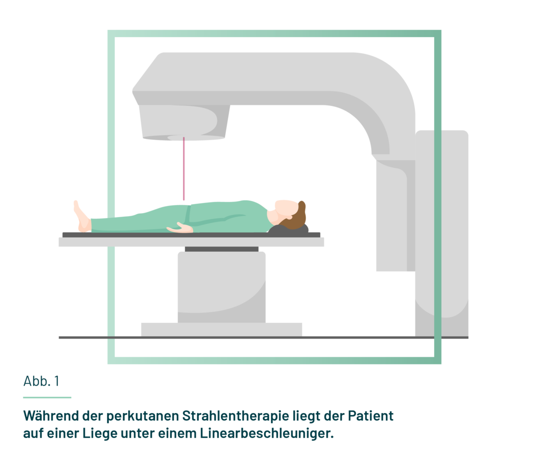 Ein Patient liegt auf einer Liege unter einem Linearbeschleuniger, der hochenergetische Strahlen auf das Krebsgewebe richtet. 