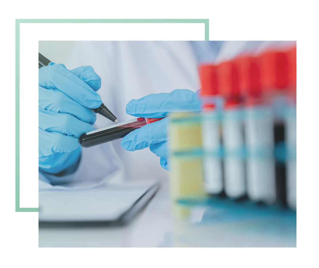 Leben mit Prostatakrebs: Eine Hand hält einen Stift und beschriftet ein Reagenzglas Eine Hand hält einen Stift und beschriftet ein Reagenzglas