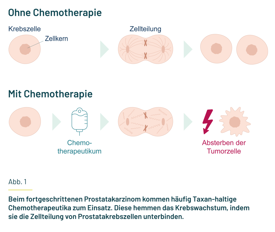 Die Abbildung zeigt schematisch, wie Taxan-haltige Chemotherapeutika das Krebswachstum hemmen, indem sie die Zellteilung von Prostatakrebszellen unterbinden.