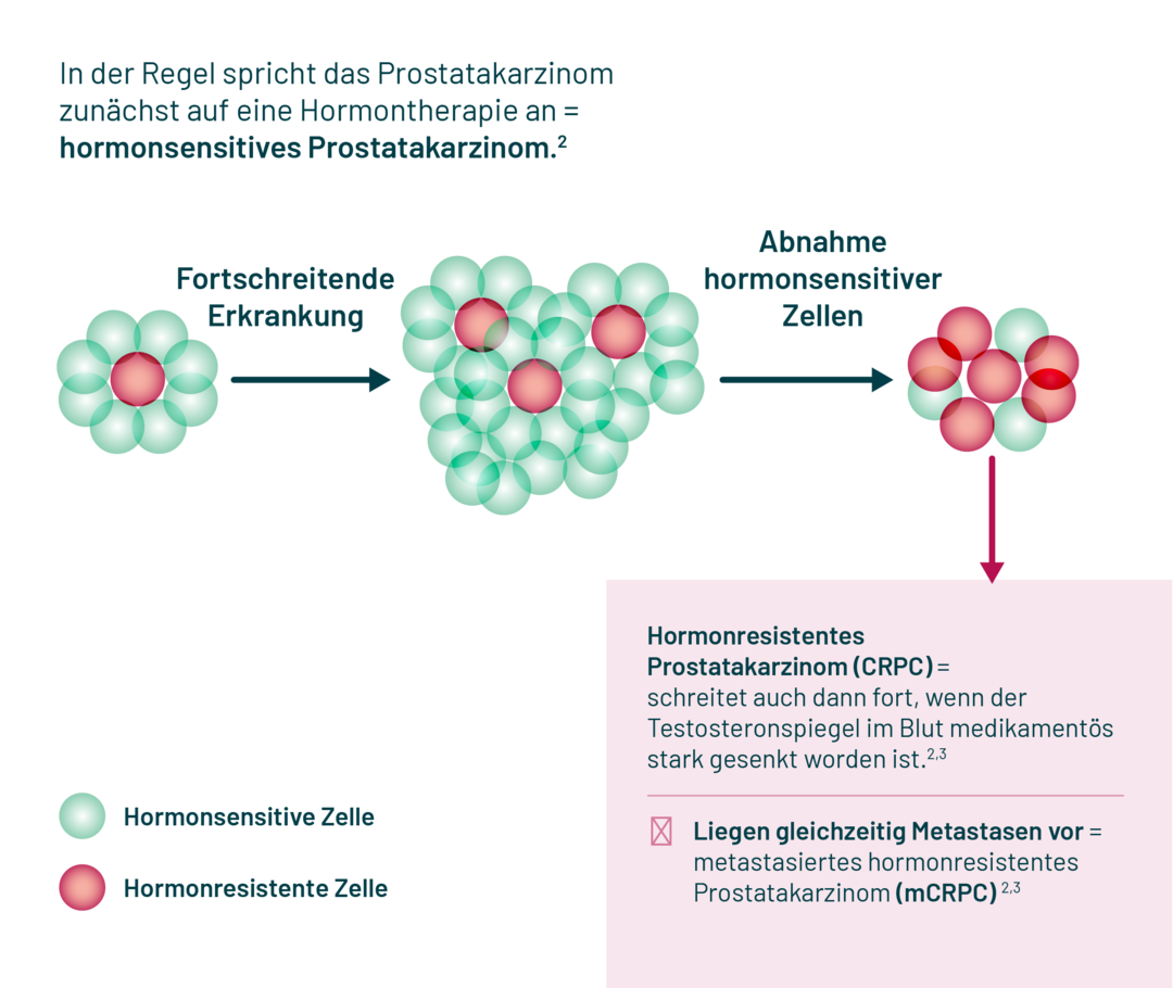 Es sind drei Ansammlungen von Zellen nebeneinander dargestellt. In jeder Ansammlung sind einige Zellen hormonsensitiv, andere hormonresistent. Von links nach rechts nimmt die Anzahl der hormonsensitiven Zellen ab. Es sind drei Ansammlungen von Zellen nebeneinander dargestellt. In jeder Ansammlung sind einige Zellen hormonsensitiv, andere hormonresistent. Von links nach rechts nimmt die Anzahl der hormonsensitiven Zellen ab.